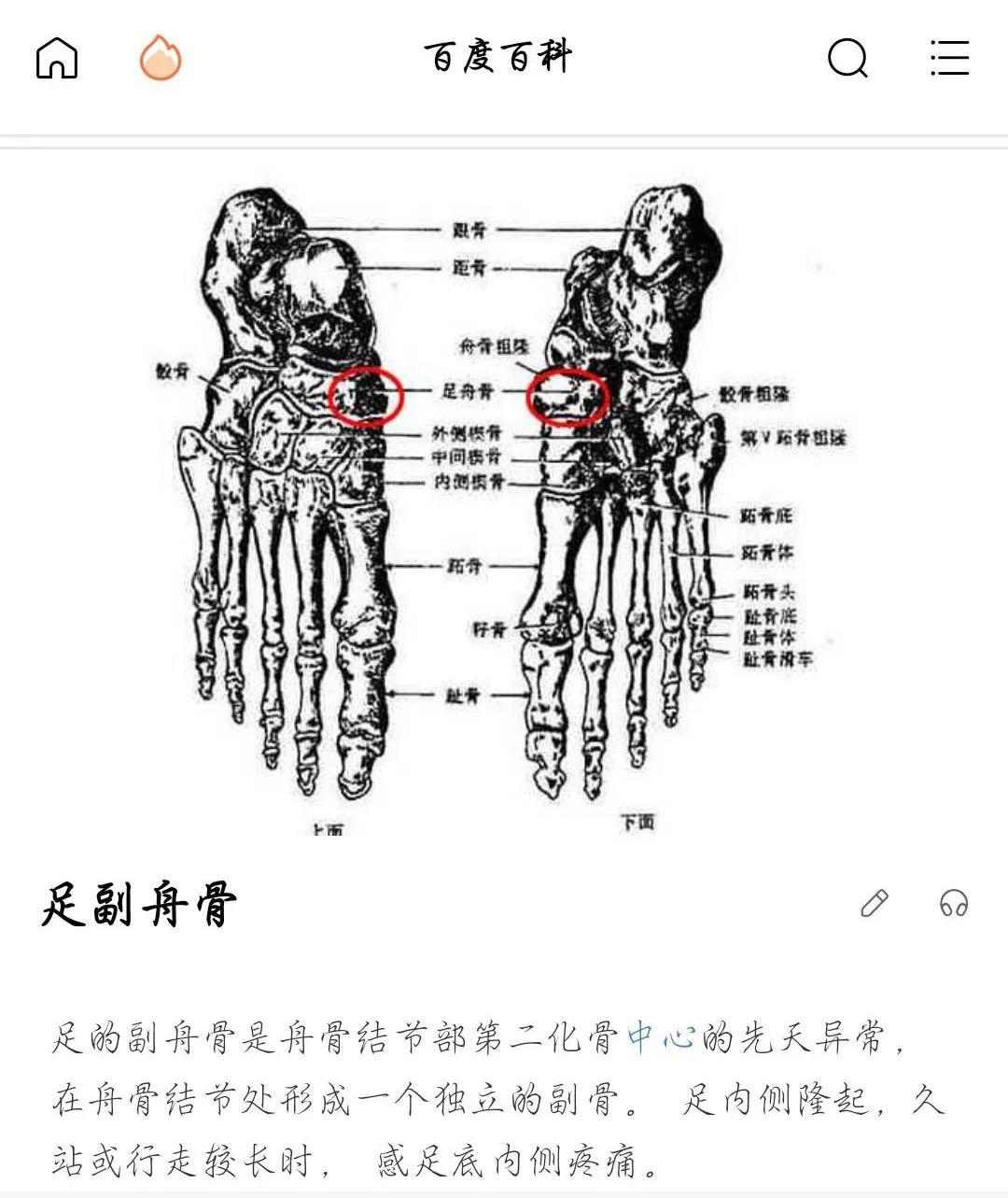 跖骨和趾骨怎么读图片