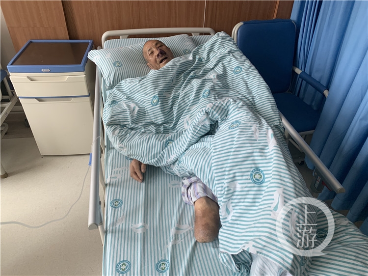 抗美援朝老兵患恶性肿瘤重庆医生为他造了一个新鼻子