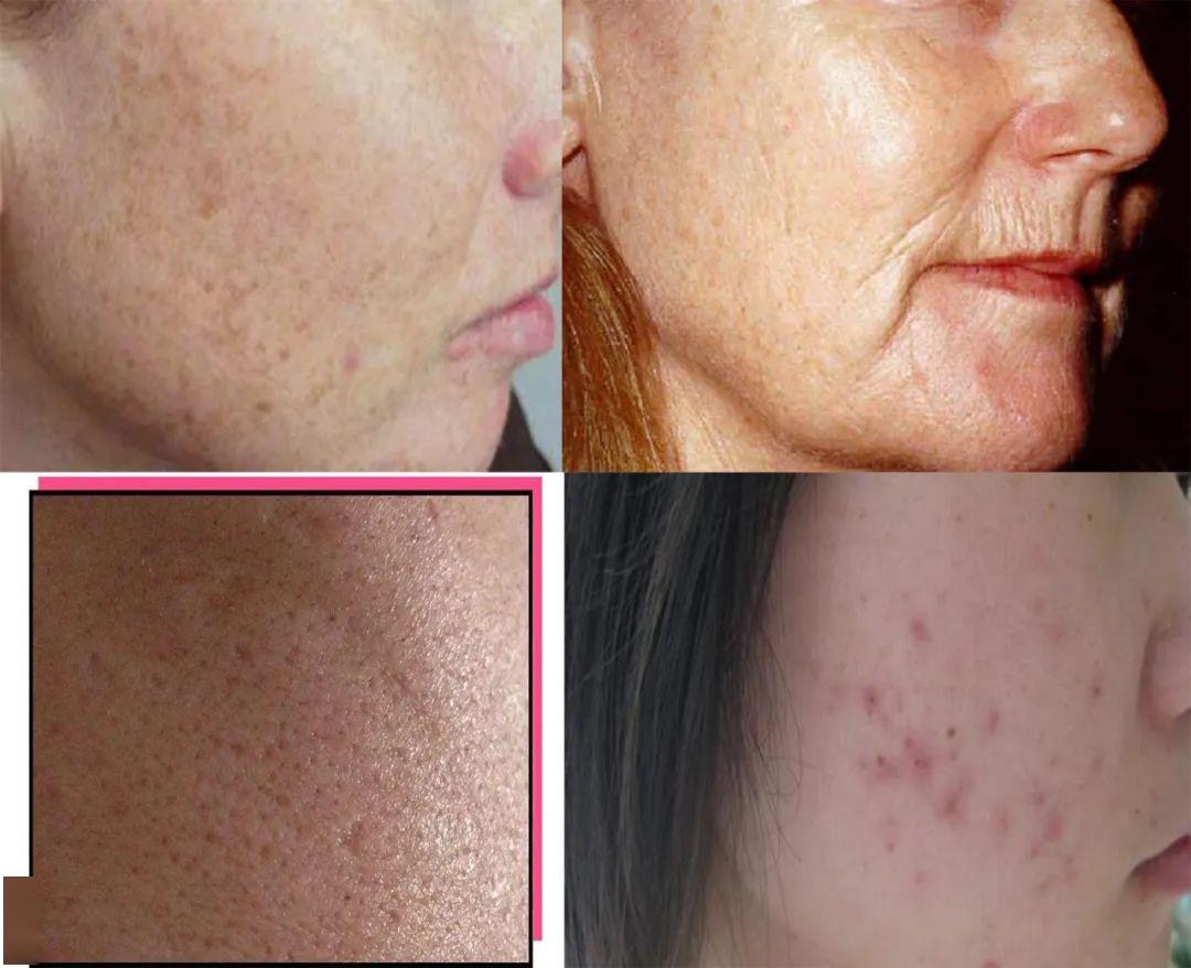 睡前有这个习惯的女生皮肤越睡越好