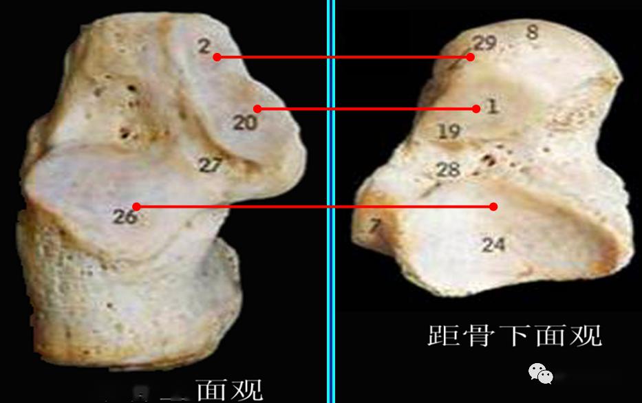 跟骨距骨解剖跟骨后距关节面:跟骨中后2/3关节面,凸度向上,与前两个