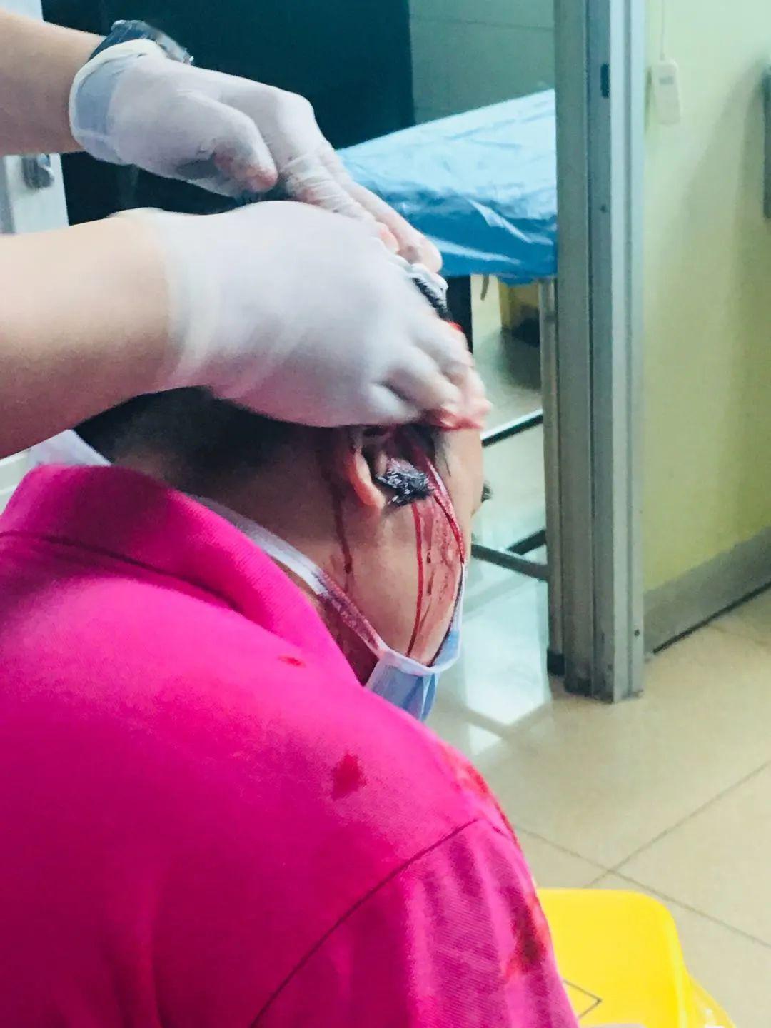 叶小姐的丈夫被高空坠落的玻璃花瓶砸中头部(受访者提供)