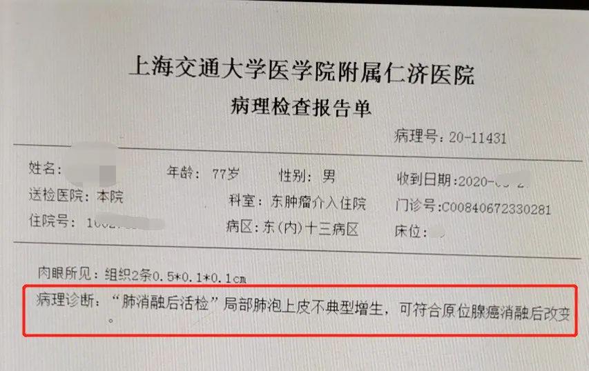 【新技术】仁济医院开展肺部磨玻璃结节无损穿刺微波消融