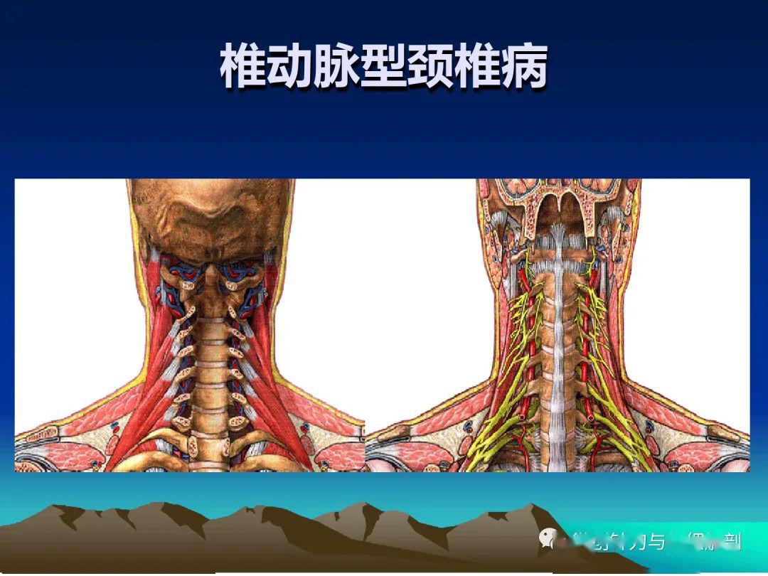 颈椎精细解剖及各种病症治疗方法