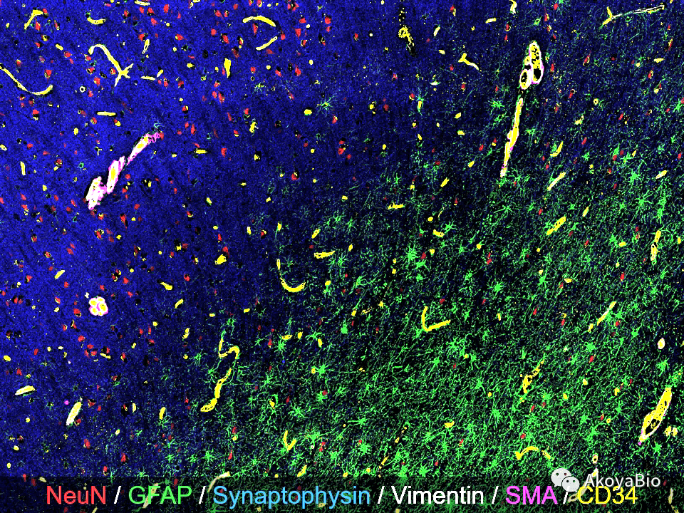 codex超多色免疫荧光和phenoptics多色免疫荧光在神经科学研究中的