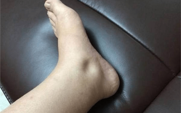 早起后的3个"表现",可能是"肝脏"受损,别再忽视了!