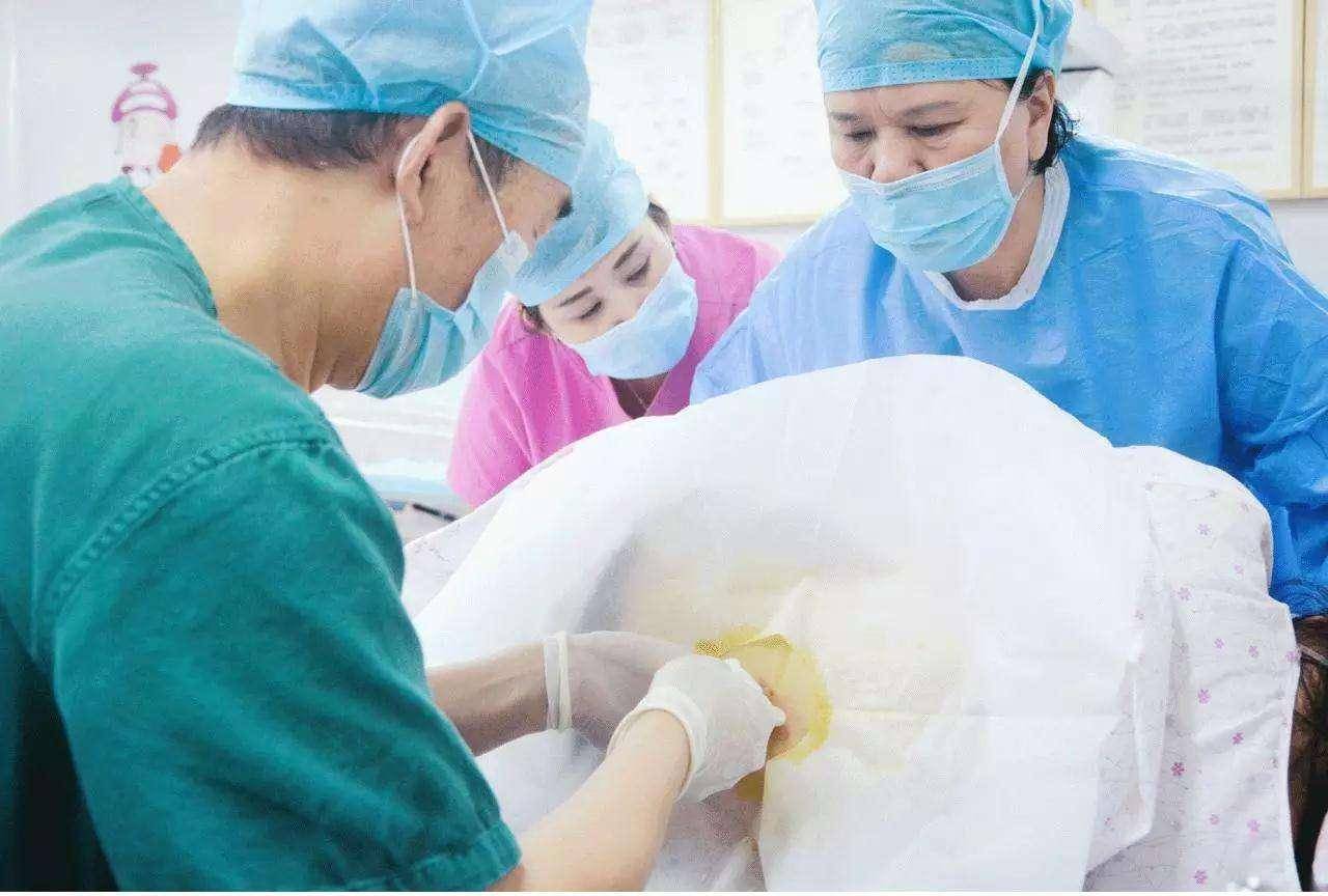 无痛分娩推行多年,为何普及率仅三成?