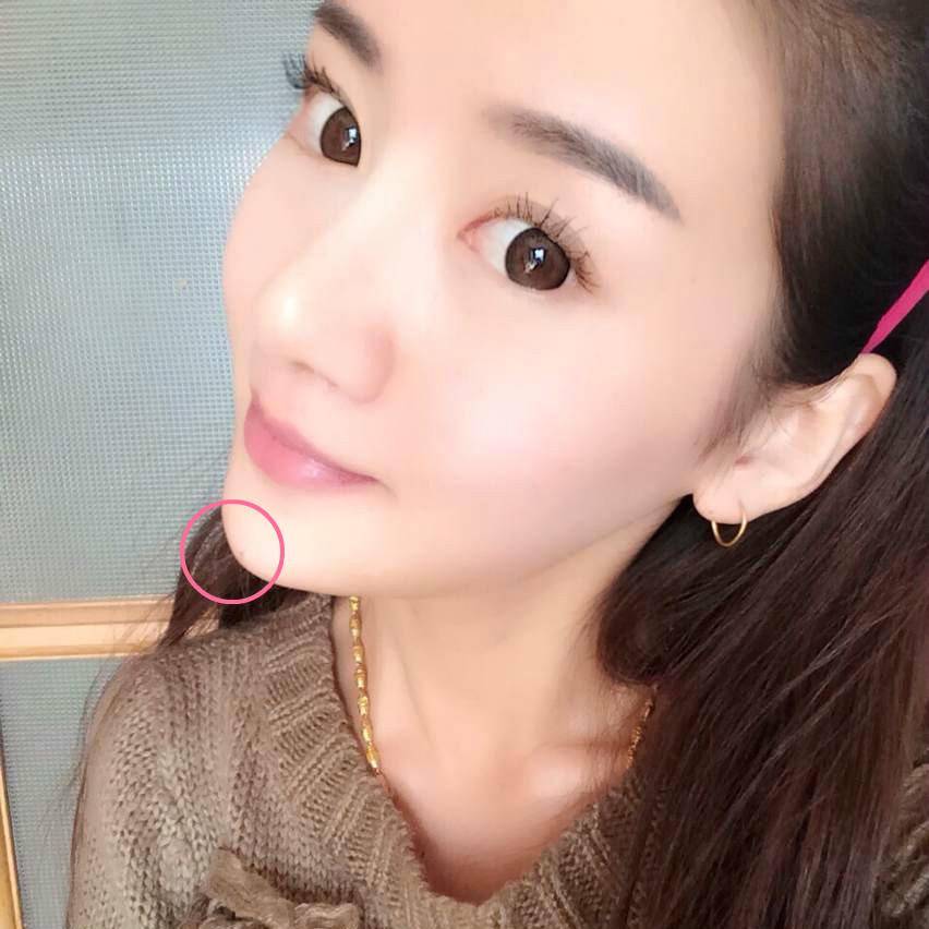整过容的女人这4个地方非常明显下巴太尖鼻梁透光