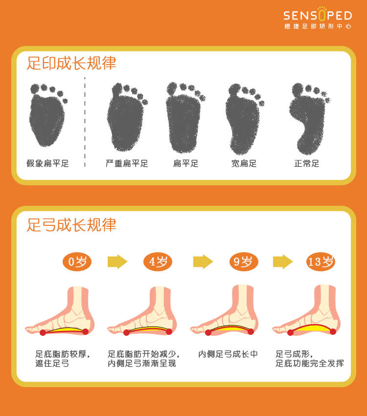 儿童足部发育过程图图片