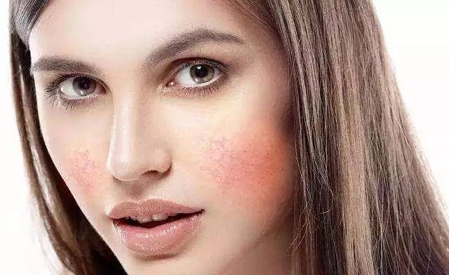 怎么让自己的皮肤状态变好 4014d337bc2e4d538f46f37df0f4d5a2.jpeg