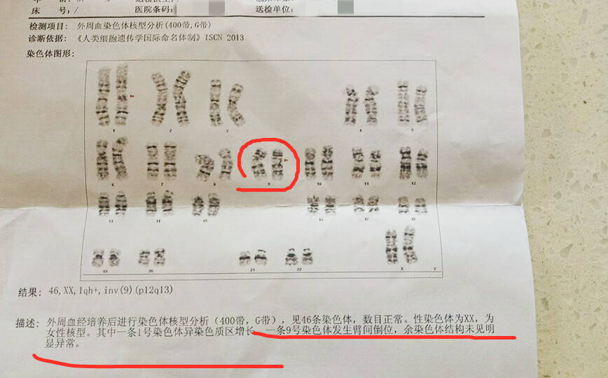 香港第三代试管婴儿费用多少？香港验血查染色体看男女准确吗？