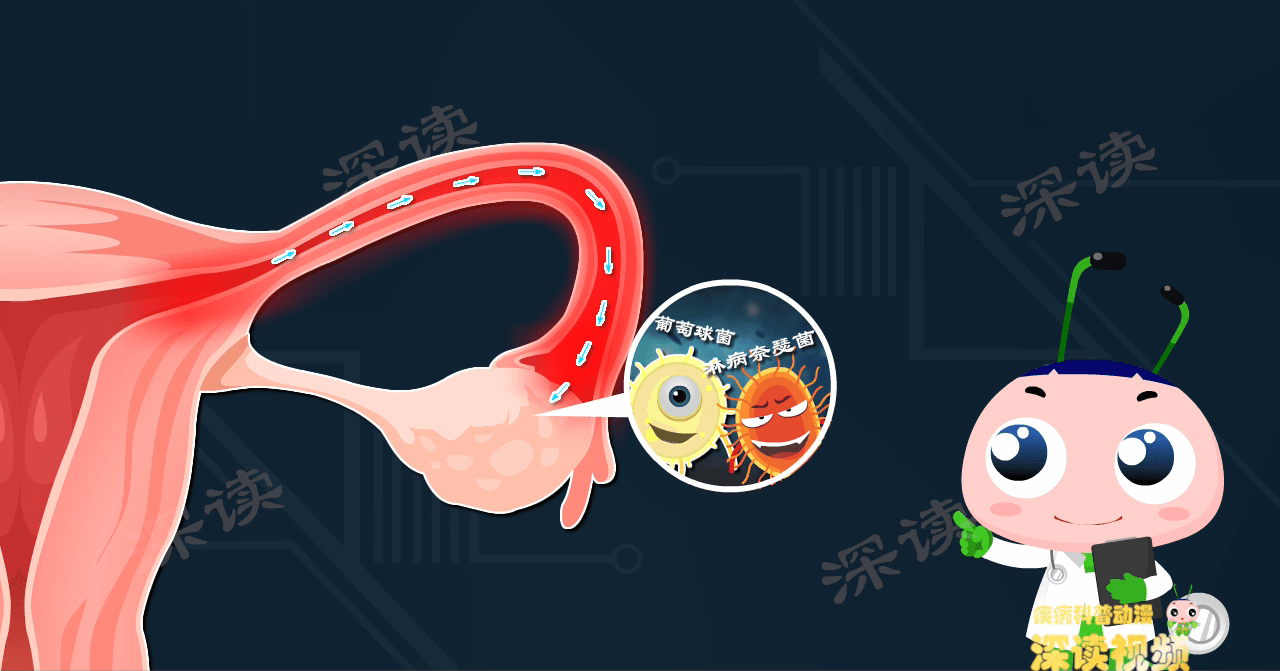 原创
腹痛、白带异常很糟心?做好这四件小事能预防卵巢炎!必看!