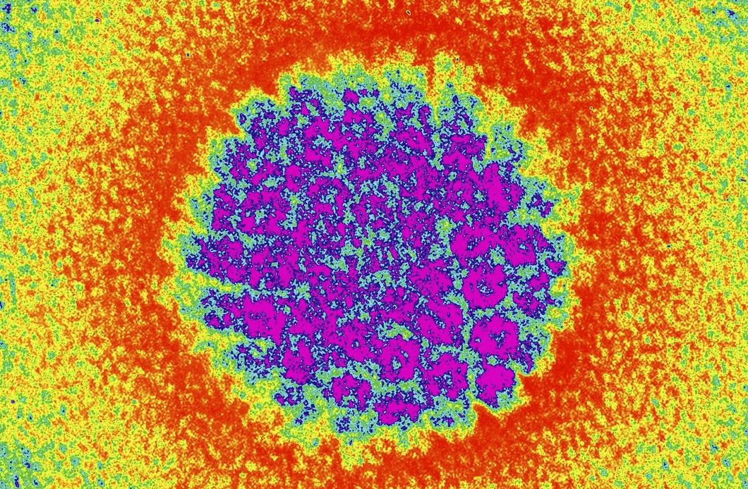 球状病毒图片