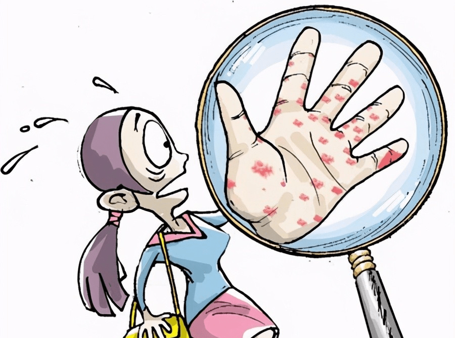 原创手上长了一堆小水泡痒到怀疑人生医生和4方面有关