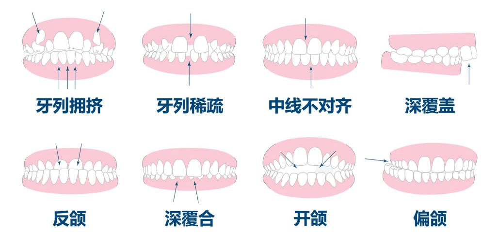 專訪唐牙科連鎖正畸專家李翔把握孩子牙齒矯正黃金期方案設計是核心