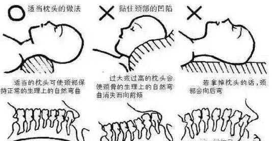 哪种运动保护颈椎 11a4d1f1e0dc44cc939e00ee80e601e0.jpeg