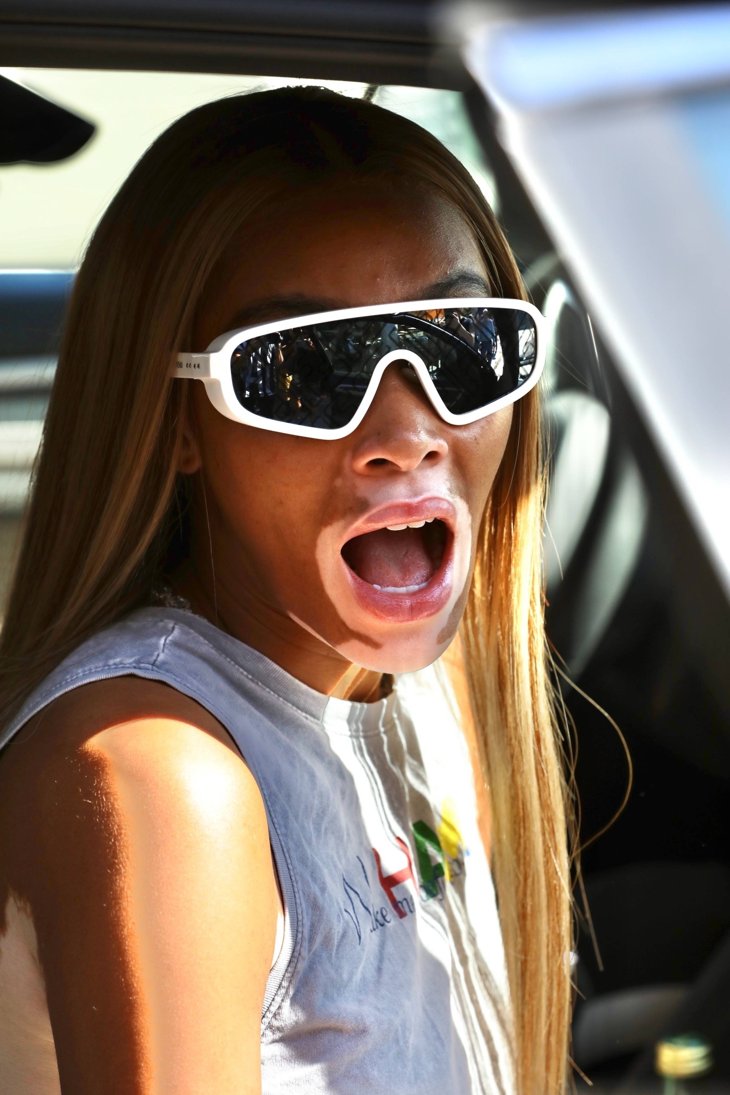 白癜风超模温妮·哈洛墨镜遮面 披长发露肩超养眼