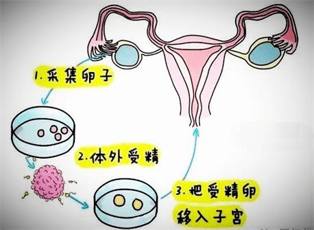 福州做试管费用是多少(福州哪家做试管婴儿成功率高)-第1张图片-鲸幼网