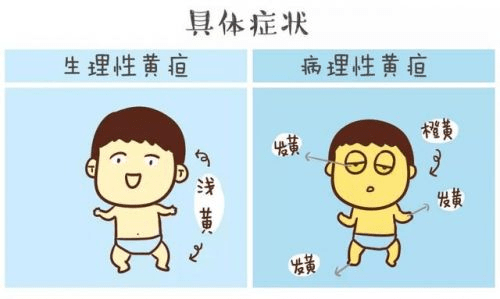 新生儿黄疸是什么舒黄健告诉您