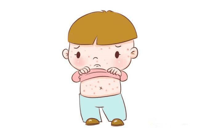 胆碱性荨麻疹发病有什么表现呢孩子皮肤瘙痒不断要当心