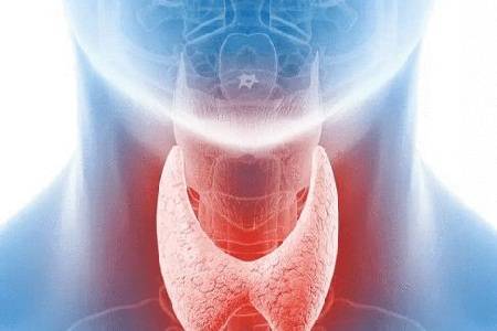 治疗|首大张洋：单纯性甲状腺肿的诊断标准