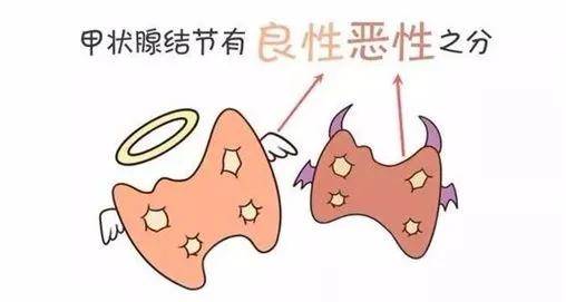 甲状腺结节病友交流群分享交流甲状腺结节的治疗经验