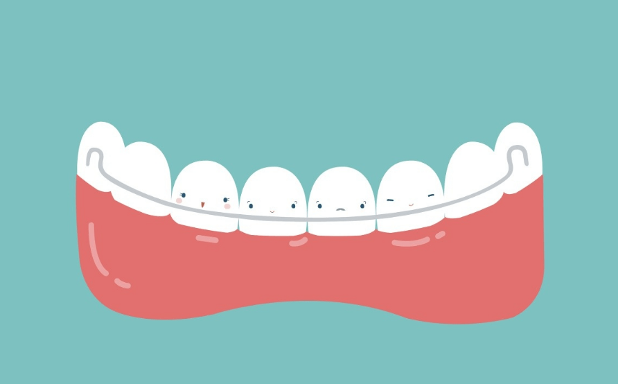为何你的牙缝又多又宽东莞做牙齿矫正可以关闭牙缝吗