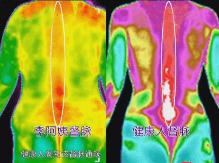 红外热成像仪的医学应用,不健康的人体热像图是怎样的?