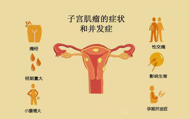 宫茹清提醒:子宫肌瘤的风险低于0.5,建议每年定期体检至少1次
