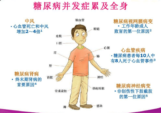 并发症|糖尿病的并发症有哪些