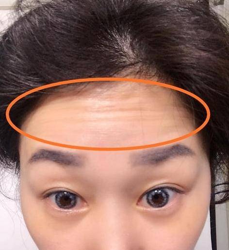 事业多奔波劳累,容易患得患失_抬头纹