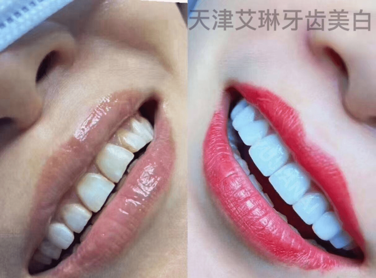 消息资讯艾琳总监天津半永久纹绣五官艺术高端定制大师