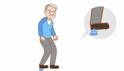 帕金森的早期症状