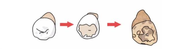 降到最低|为什么喝完可乐不能马上刷牙？