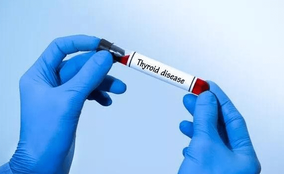 治疗|甲状腺专家王占荣分享：三分钟了解甲状腺功能异常的表现，以及治疗方法