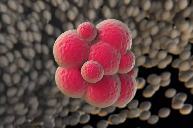 治疗|干细胞疗法在4类肾脏疾病治疗中的临床应用进展