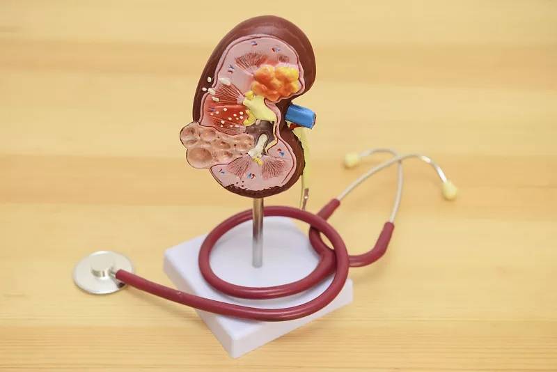 治疗|干细胞疗法在4类肾脏疾病治疗中的临床应用进展