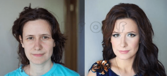 能量线雕手术后几天才可以恢复好、全脸线雕多久完全恢复