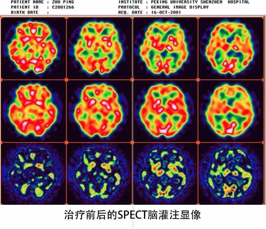 生命|关于生命光动仪，你想知道的都在这里！