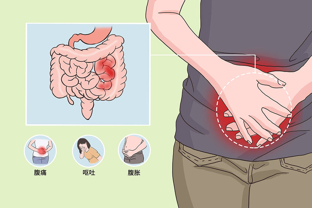 进行|肠白塞病右下腹疼痛怎么缓解