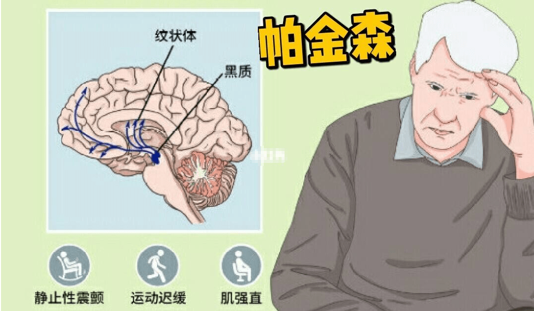 精准的评估是帕金森病脑起搏器手术治疗的前提