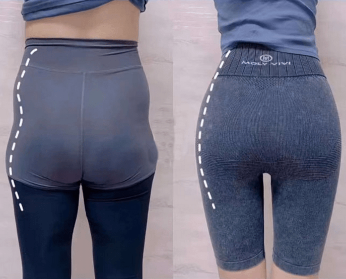 干货|妈妈臀的形成原因和解决方法臀部在我们的背影中