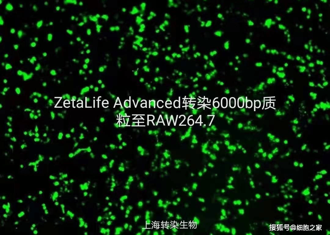 RAW264.7 (小鼠单核巨噬细胞白血病细胞)的质粒转染非我不可？_手机搜狐网