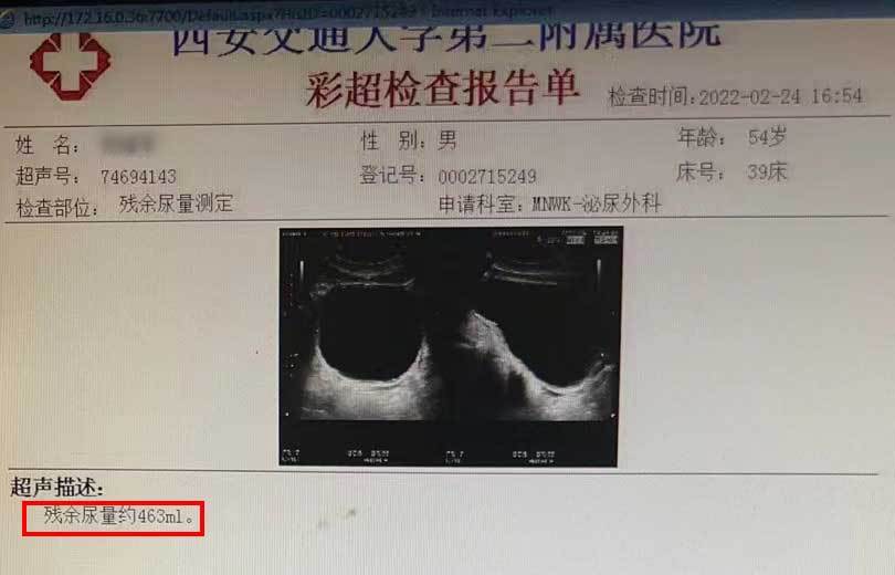 男子每天小便20次以上小小膀胱起搏器幫他遠離尷尬