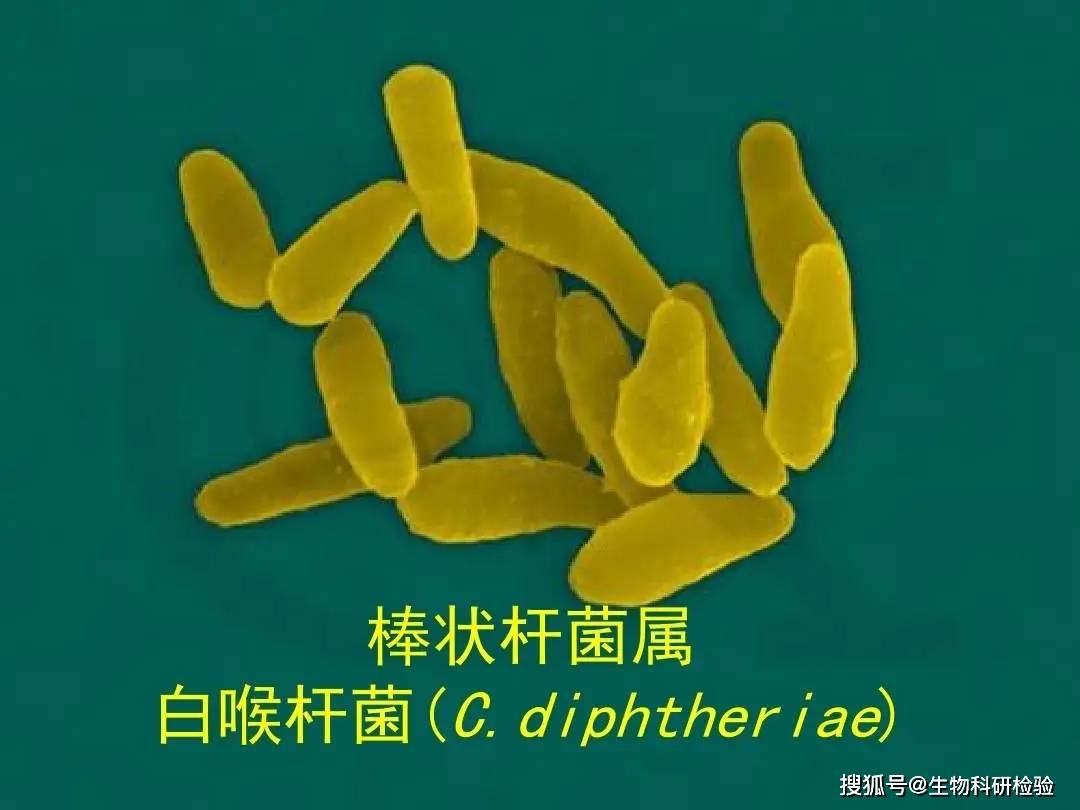解析：白喉棒状杆菌检测试剂说明