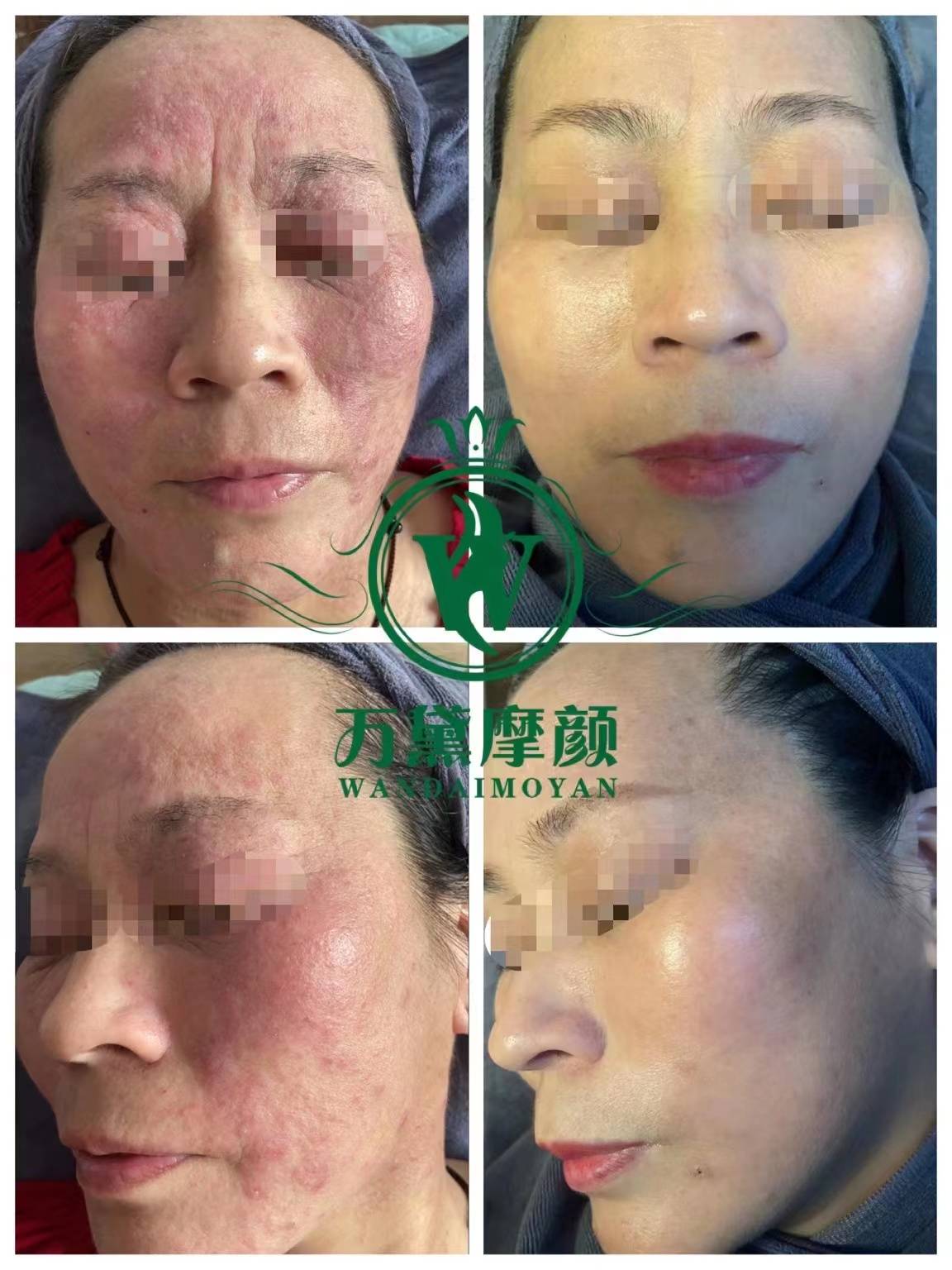 万黛摩颜为美而来