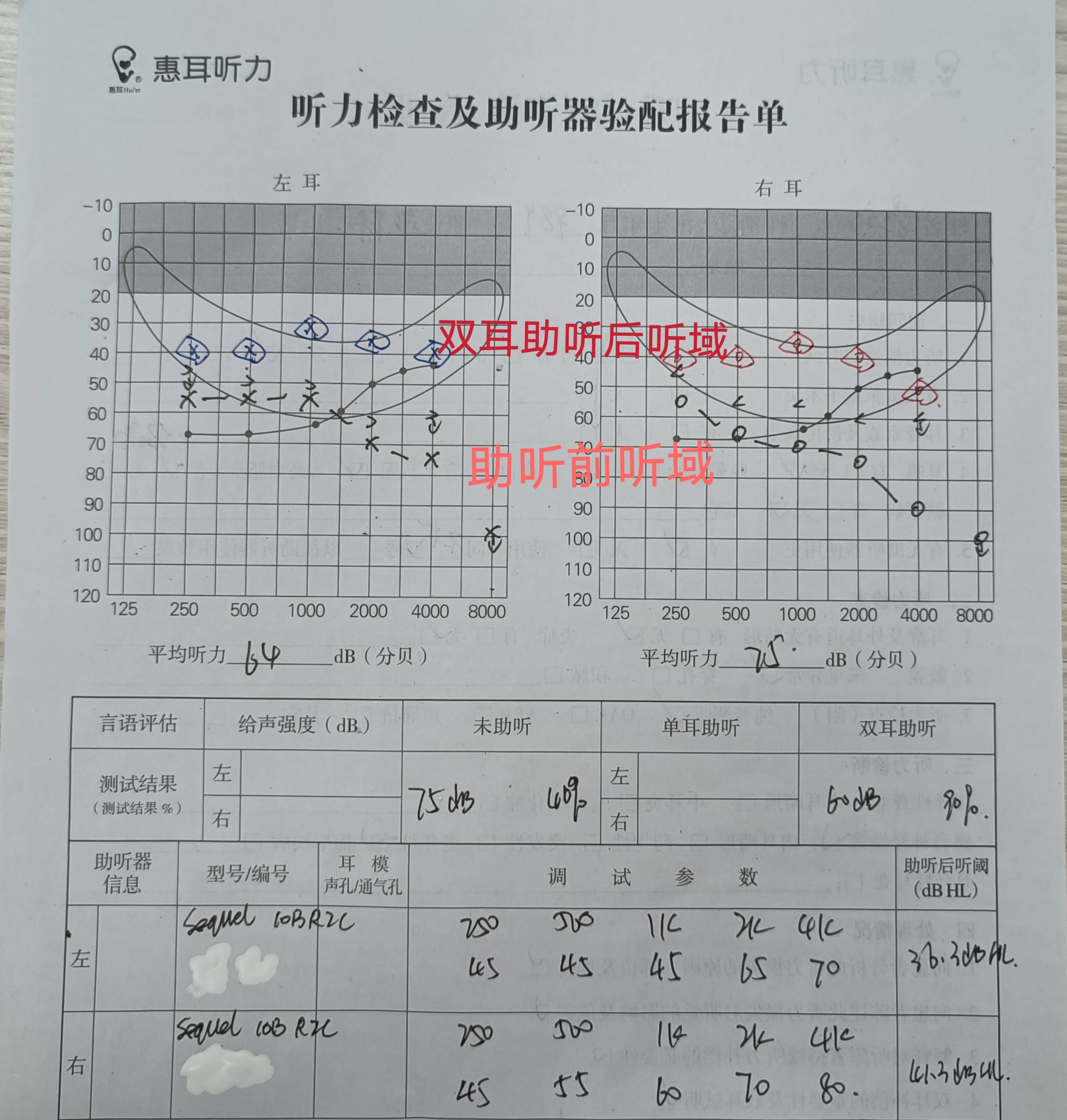 耳镜检查报告图片图片