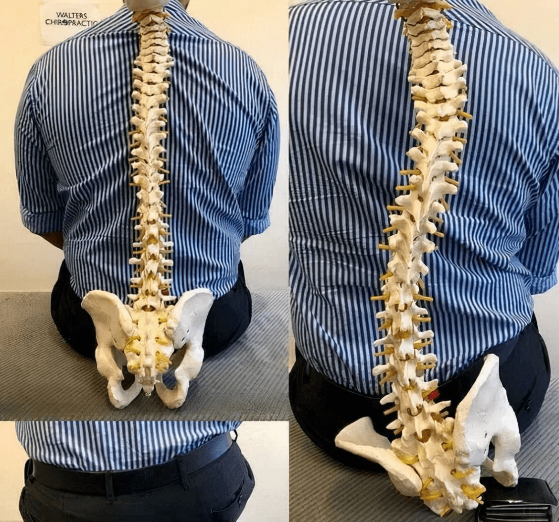 赶紧看看自己有没中招_脊柱_骨盆_体式