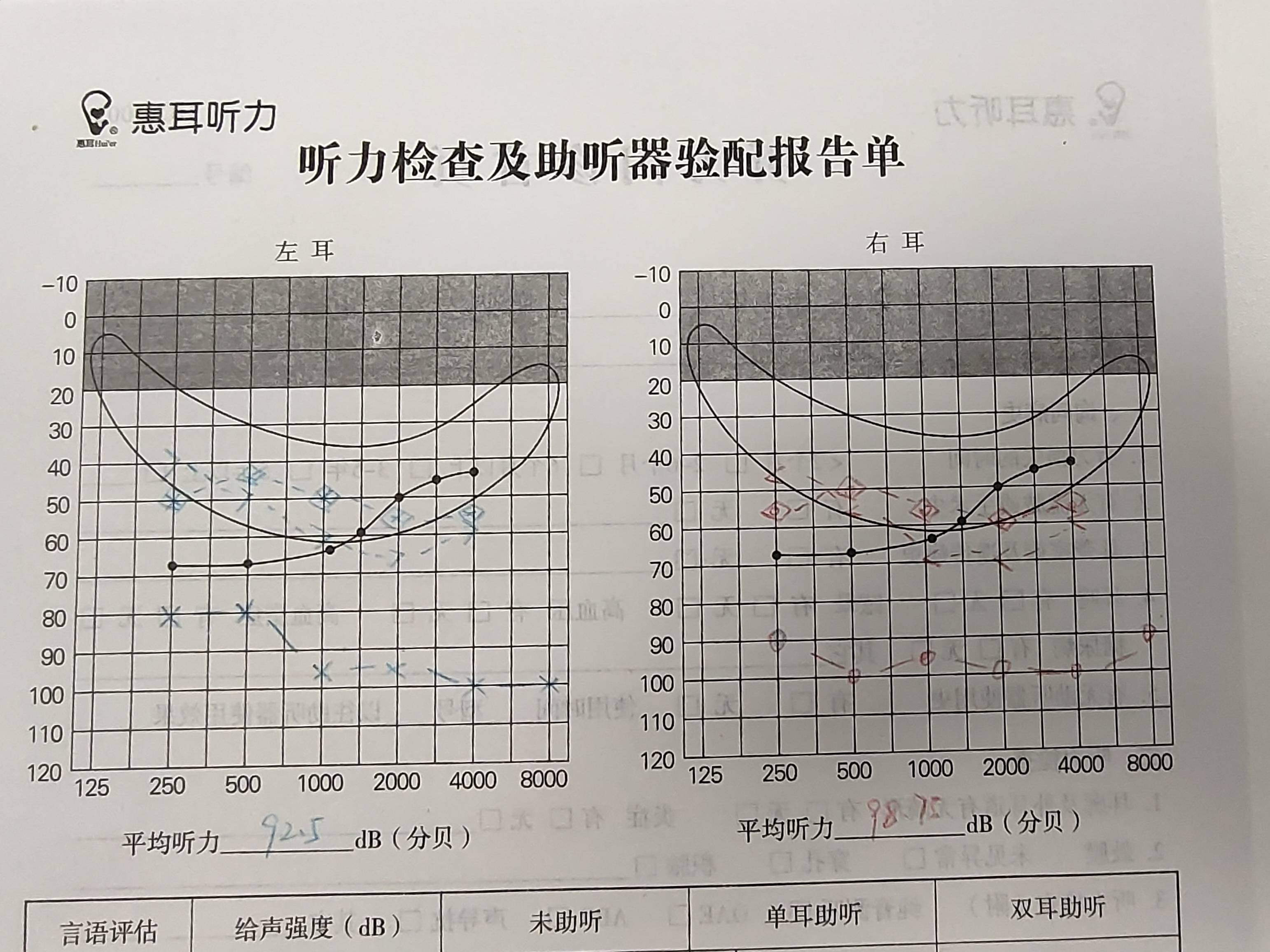 听力测试报告单图片