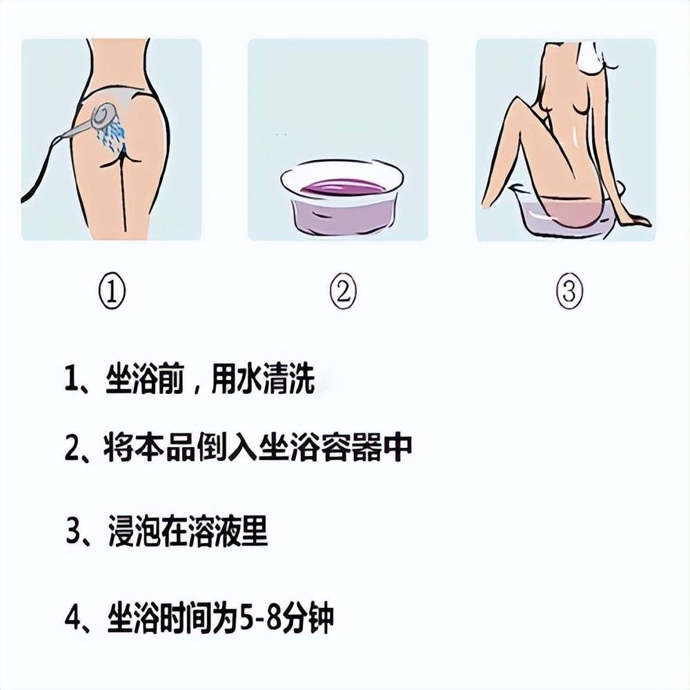 其次,熏洗坐浴这也是重中之重,痔疮和便秘算是老熟