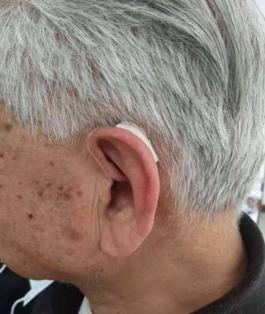 听损人群,舒适度较高,电池比较大,对于手部不灵活的老人来说更容易